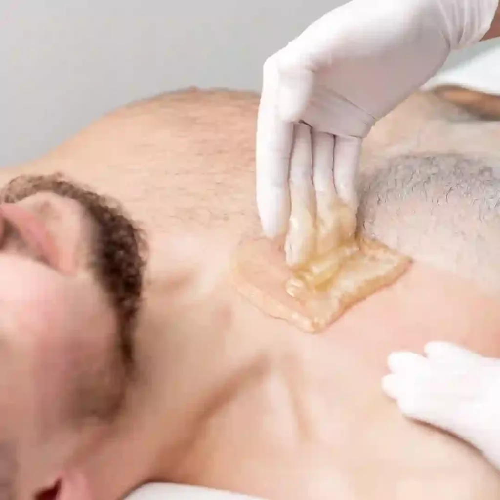 Depilação Masculina Peito
