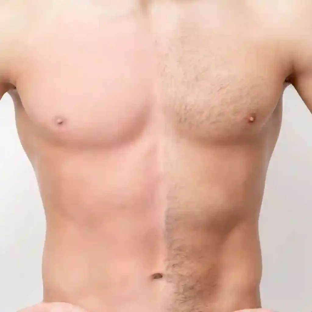 Depilação Masculina Intima